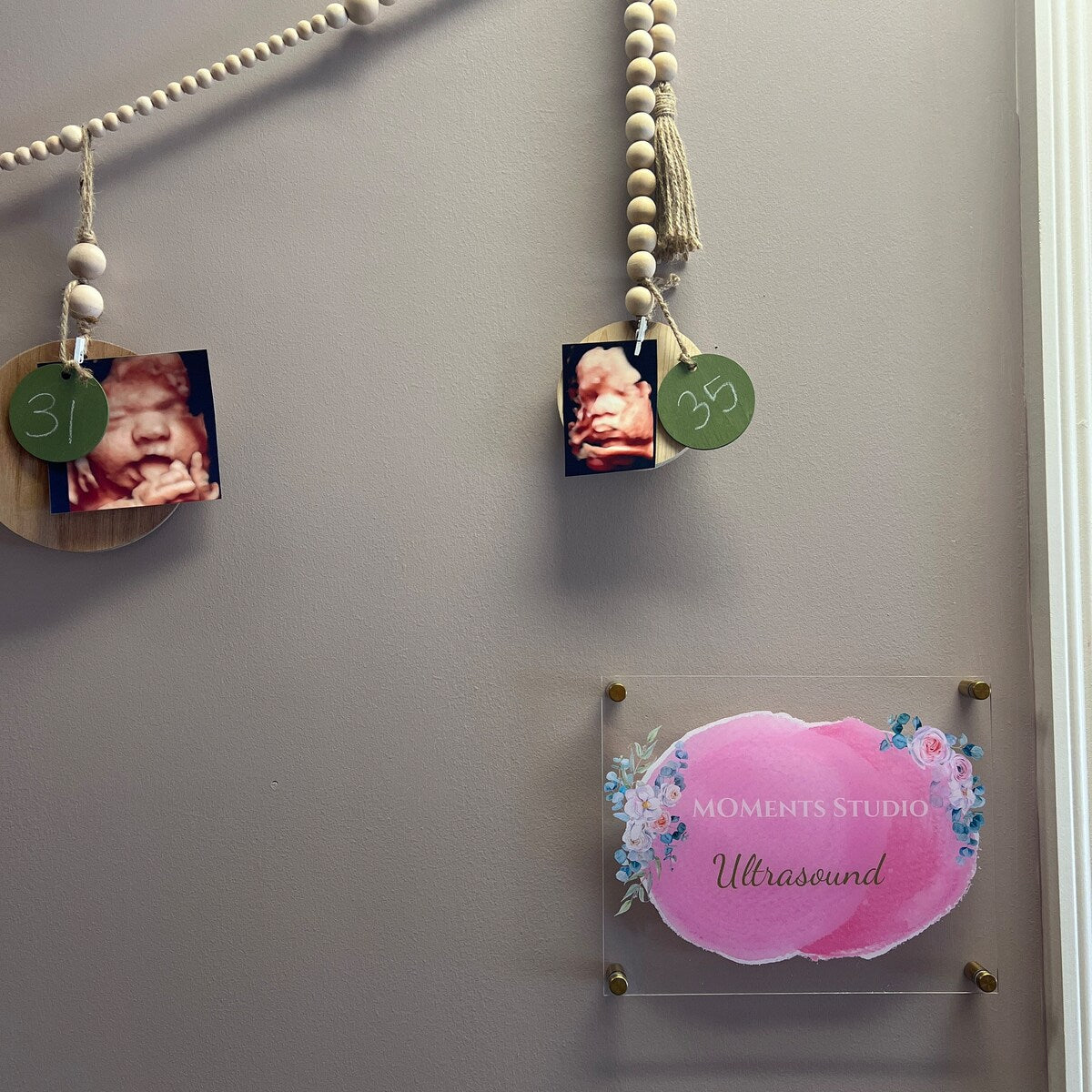 Decorative wall with baby milestone cards and 'Moments Studio' ultrasound display.